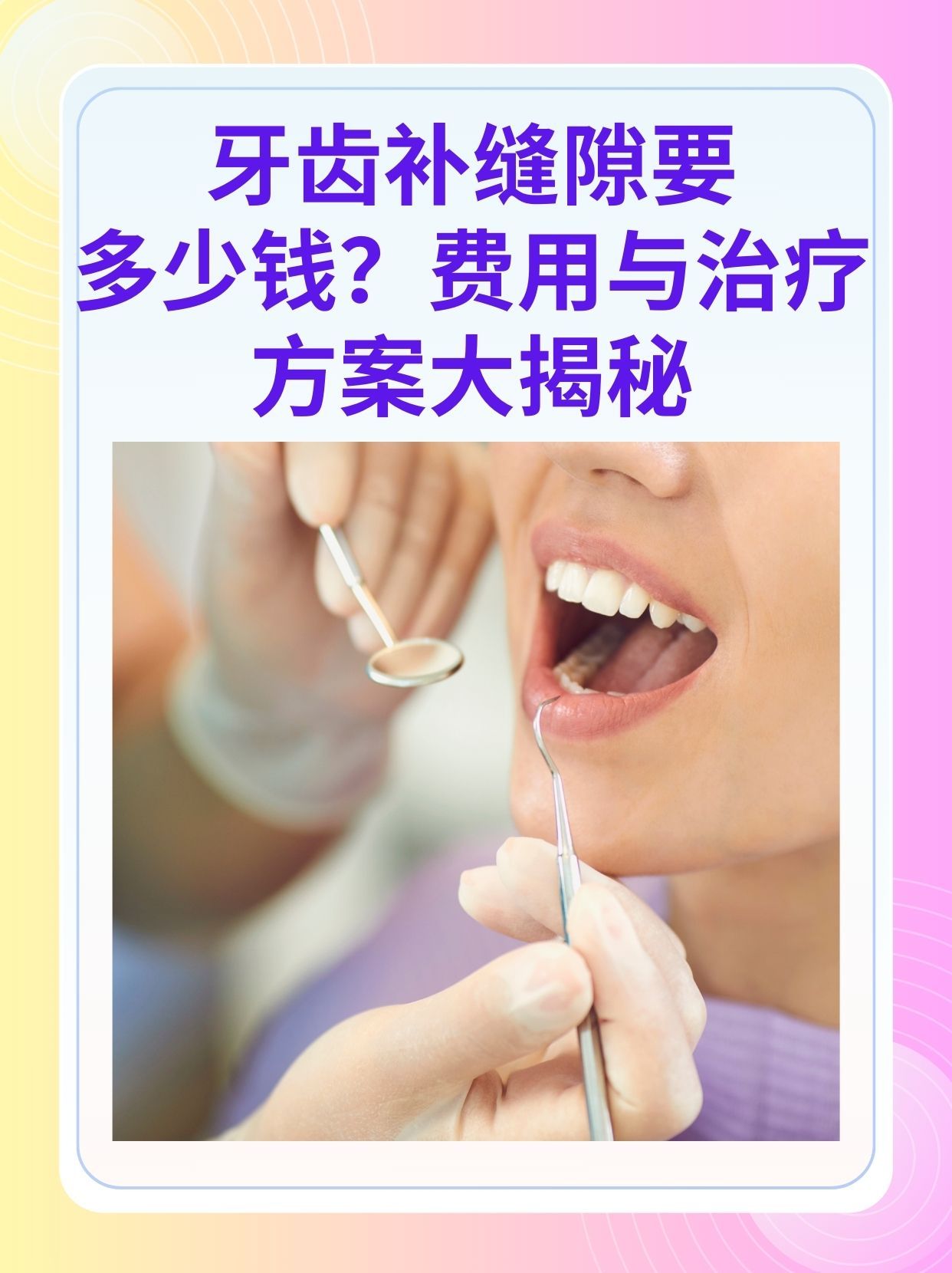 芜湖补牙医保可以报销吗(补牙医保可以报销吗 哪些可以报销呢)